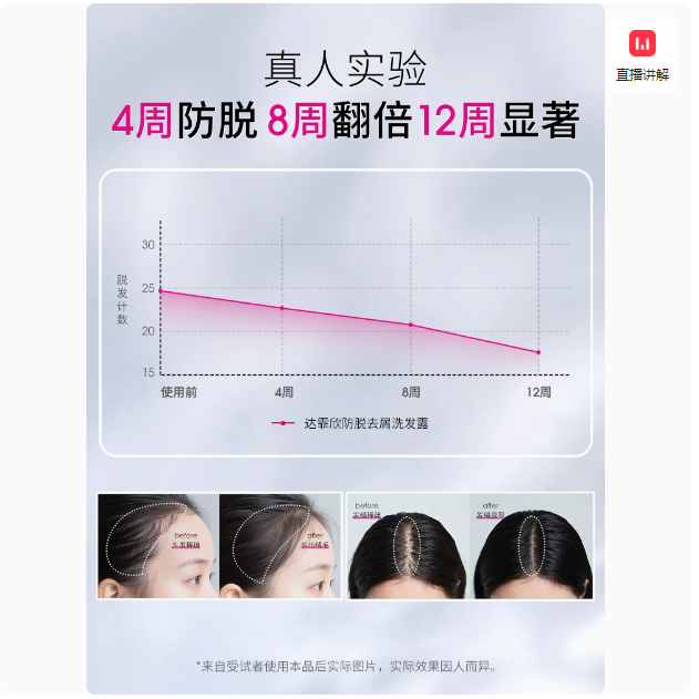 持證特護(hù)，達(dá)霏欣 澳威雅 升級(jí)款防脫育發(fā)洗發(fā)露 300ml44元包郵
